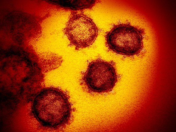 Trois personnes de moins de 19 ans sont mortes en Suisse après avoir été contaminées par le coronavirus (archives). © KEYSTONE/EPA NATIONAL INSTITUTES OF HEALTH/NIAID- RML/NATIONAL INS