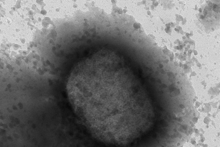 La variole du singe est une maladie infectieuse causée par un virus qui se transmet de l'animal à l'humain, mais qui peut aussi se transmettre d'humain à humain. © KEYSTONE/AP