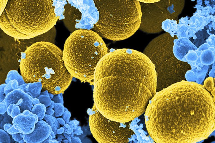 Le staphylocoque doré est "la principale cause bactérienne de décès dans 135 pays" (archives). © KEYSTONE/AP NIAID